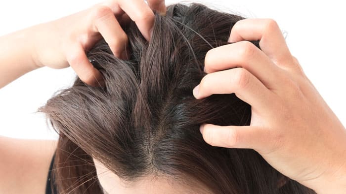 علاج حكة فروة الراس وتساقط الشعر