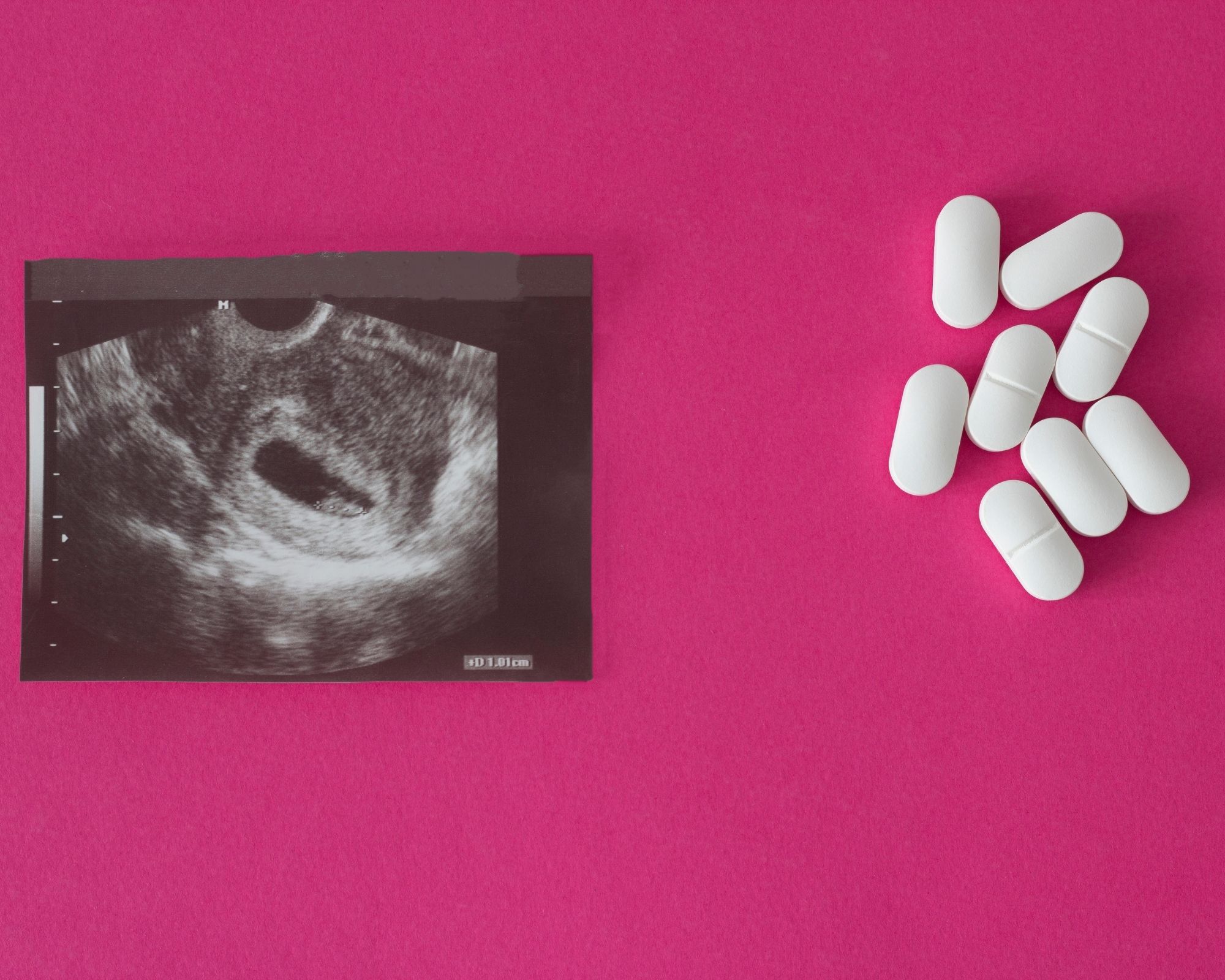 كيفية تنظيف الرحم بعد الإجهاض في الشهر الثاني