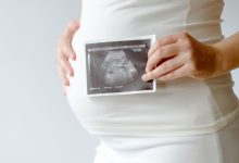 الإفرازات البيضاء للحامل ونوع الجنين